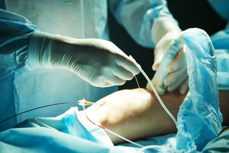 Vascular Surgery Photo